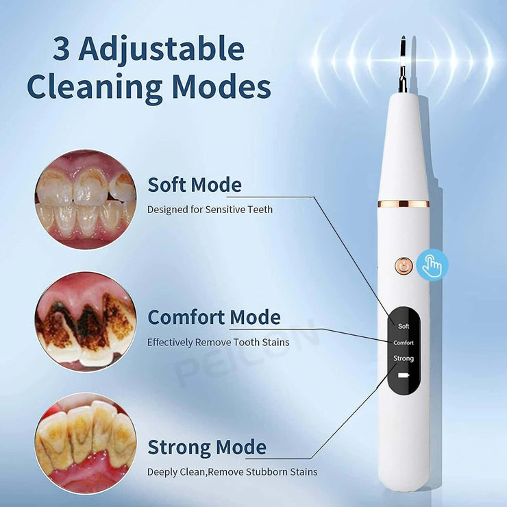 Ultrasonic Dental Teeth Plaque Remover & Cleaner - ELECTRONIC GADGETS