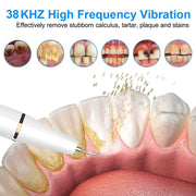 Ultrasonic Dental Teeth Plaque Remover & Cleaner - ELECTRONIC GADGETS