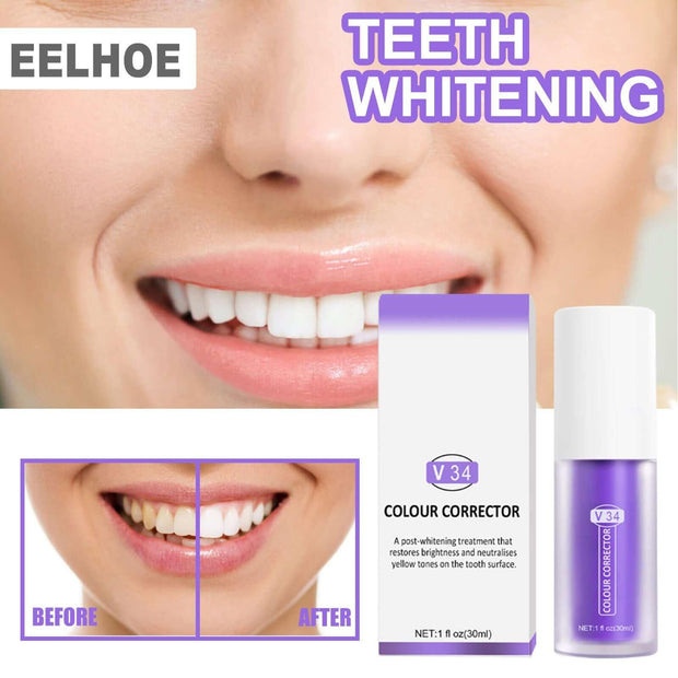 2x Whitening Toothpaste - ELECTRONIC GADGETS